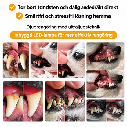 Novullo™ - Ultraljud tandsten - borttagaren
