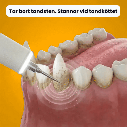 Novullo™ - Ultraljud tandsten - borttagaren